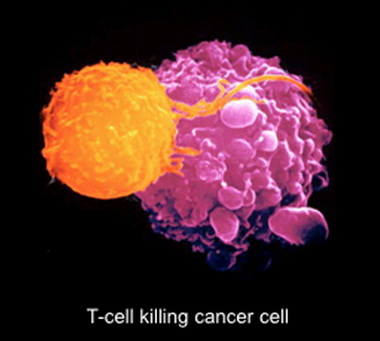 t-cell killing cancer cell